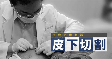 人中受傷|好醜！受傷為何會留疤？醫曝「4大影響因子」：這2部位最難消失。